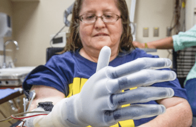 Female using her U-M designed robotic hand.