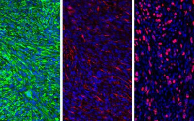 U-M Rogel Cancer Center scientists collaborated with multiple labs on research that could lead to a new way of treating brain tumors.