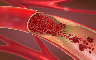 Massive international study uncovers genes involved in heart disease