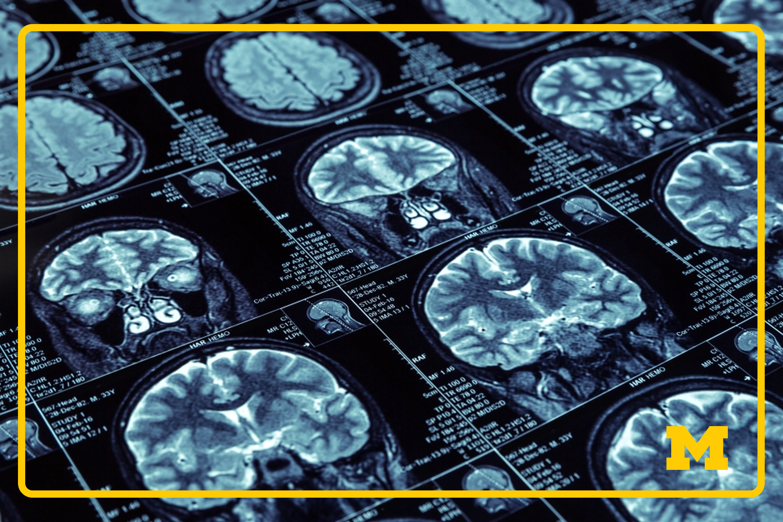 Alzheimer's research