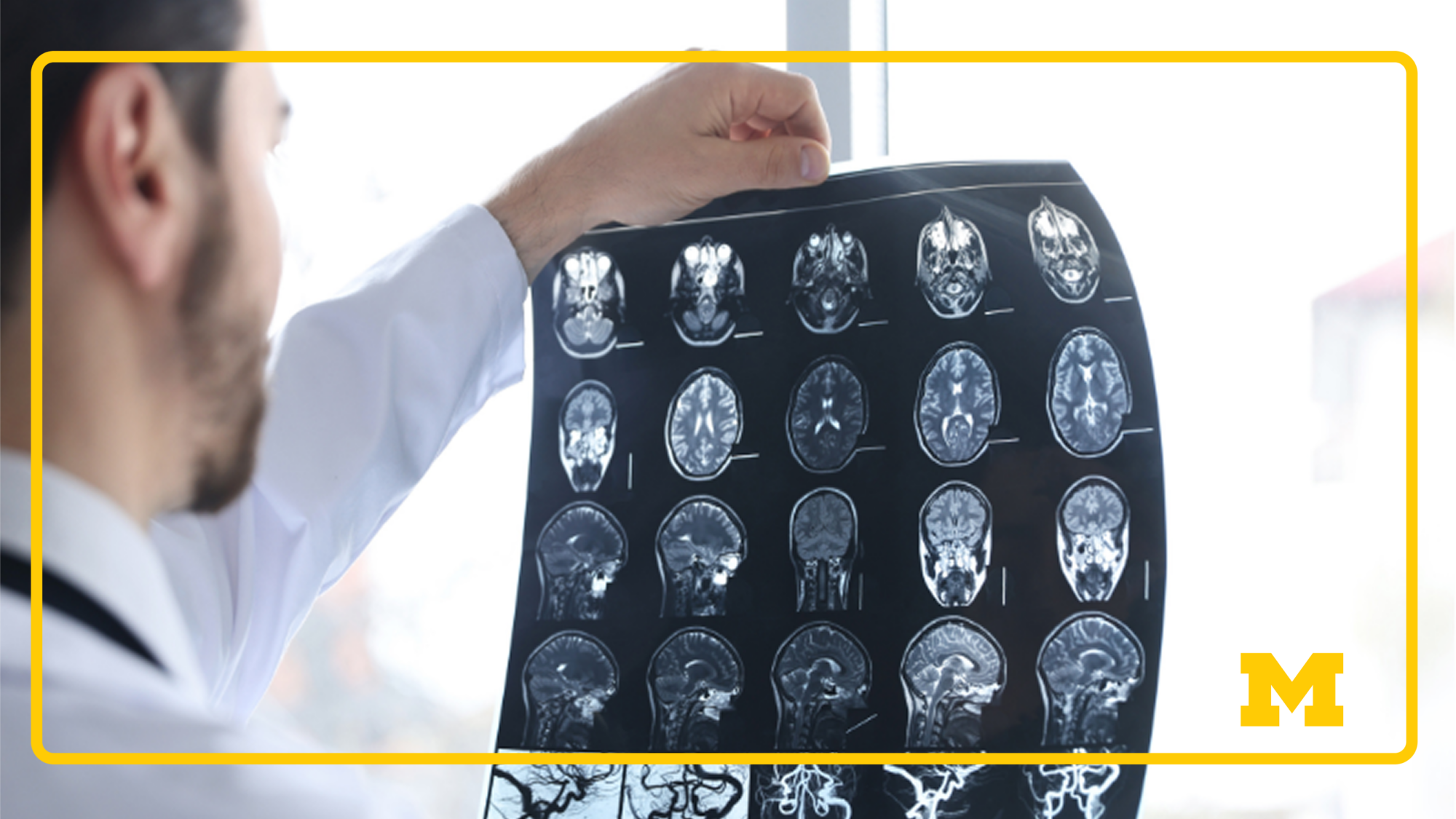 A medical professional wearing a white coat examines a large sheet of brain MRI scans in front of a window.