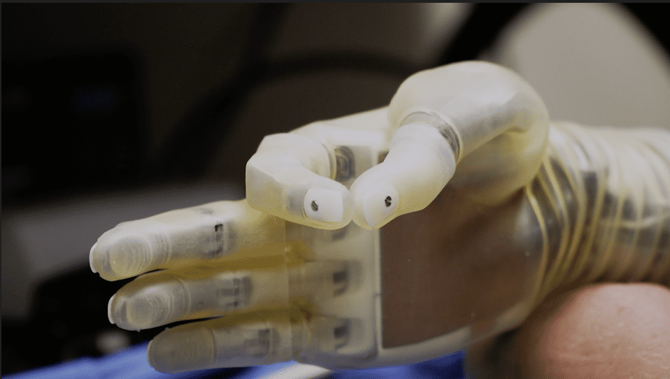 A translucent robotic hand with articulated fingers is shown in close-up, highlighting advances in prosthetic and biomedical engineering.