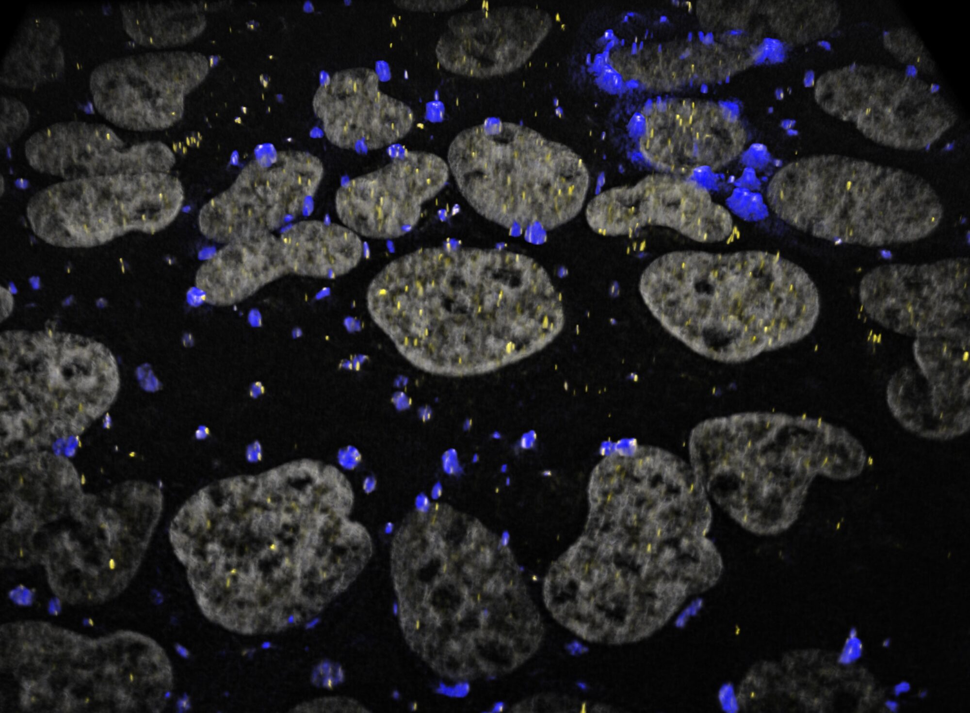 Microscopy image showing many gray, bean-shaped structures on a black background with scattered blue puncta and fine yellow speckles throughout.