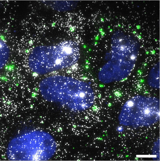 Microscopy image showing many gray, bean-shaped structures on a black background with scattered blue puncta and fine yellow speckles throughout.