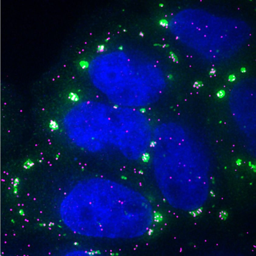 Fluorescence micrograph showing several large blue oval nuclei surrounded by scattered bright green clusters and many small magenta puncta on a dark background.